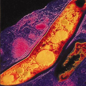 Bacteria responsable de la tuberculosis