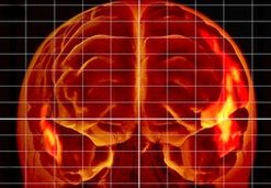 cerebro