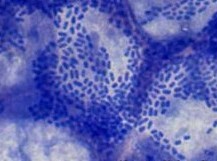 bacteria