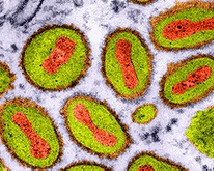 virus