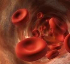 hemophilia
