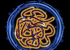 hepatitis C