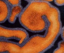 virus ébola