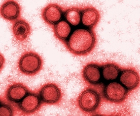 Using genes resurrected from the 1918 Spanish influenza virus, the virus responsible for a pandemic that killed an estimated 20 million people, scientists have gathered important new clues to why the virus spread quickly and killed efficiently. Adding the genes to a comparatively benign strain of influenza (pictured), shows that a minor genetic change can turn a mild form of the virus into a highly virulent strain. Used with permission by: UW-Madison University Communications 608/262-0067Photo by: courtesy Yoshihiro Kawaoka, University of Wisconsin-MadisonDate: 9/04 File#: scan provided