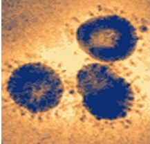 virus sras