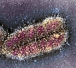 cromosoma