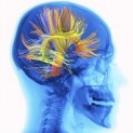 brain