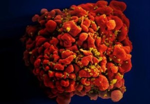 HIV