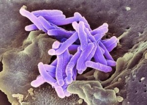 bacilo tuberculosis