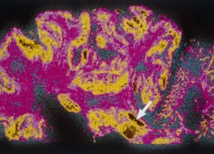 cerebro scan