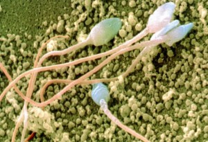 espermatozoides