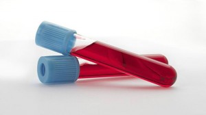 examen_sangre_624x351_bbc_nocredit