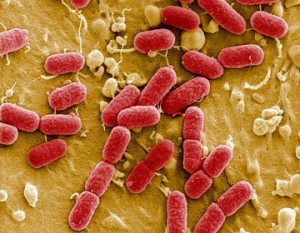 bacteria-ecoli