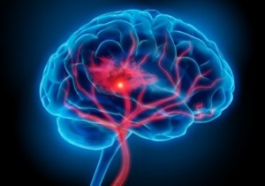 Cerebro