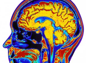 cerebro