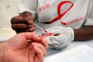 HIV