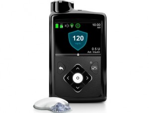 Pancreas Device-FDA
