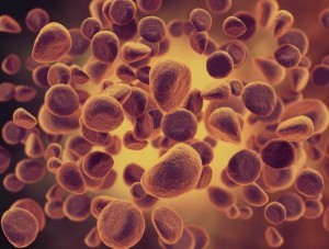 leucemia-mieloide-aguda-300x227
