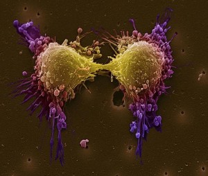 cancer piel