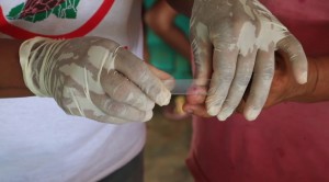 malaria