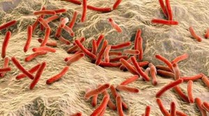 leprabacteria