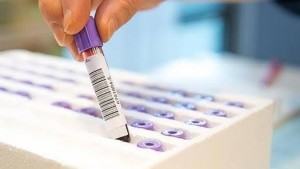 bloodtest-kF0--1240x698@abc