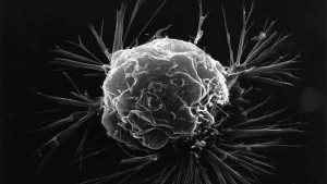 celula cancer mama