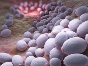candidiasis
