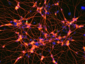 neurona