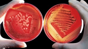 bacterias-kSAC--620x349@abc