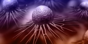 cancer-de-cervix