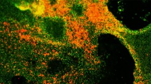 cancer-pulmon-agr-kIMI--620x349@abc