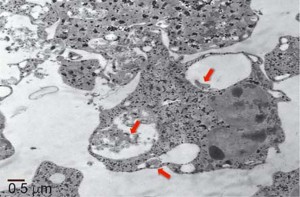 lestospirosis-Bacterias-no-patógenas-fagocitadas