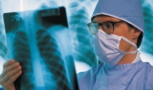 tuberculosis-1