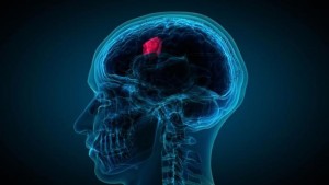 Glioblastoma-k9NB--1240x698@abc