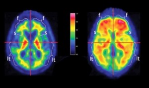 cerebro