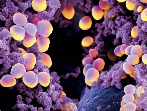 Un-nuevo-antibiotico-de-tipo-LEGO-para-vencer-a-las-bacterias-resistentes