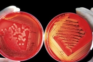 cancer-genetica-kqgB--620x349@abc
