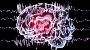 electroencefalograma