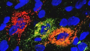 neurona-kUgB--620x349@abc