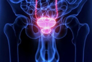 prostata-1