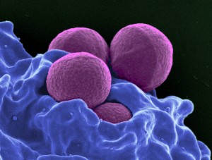 neutrofilos-en-la-sangre-1024x776