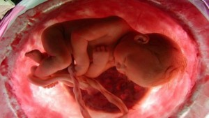 bebe-placenta
