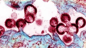 VIH-cells-kRPE--620x349@abc