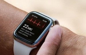 AppleWatch