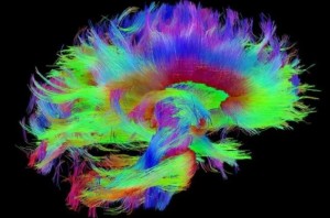 cerebro