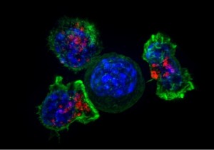 cancer-cells-RMFVKnjaE8Se1ayLqkQuD3O-758x531@abc