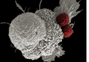 cell-cancer-RftZpNuDYyoC8OFd477BBMM-758x531@abc