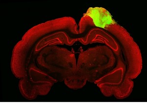 cerebro rata