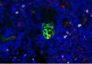 Cancer-cell-R7xKbTwFi8oNE5ZoNDUQJkJ-758x531@abc